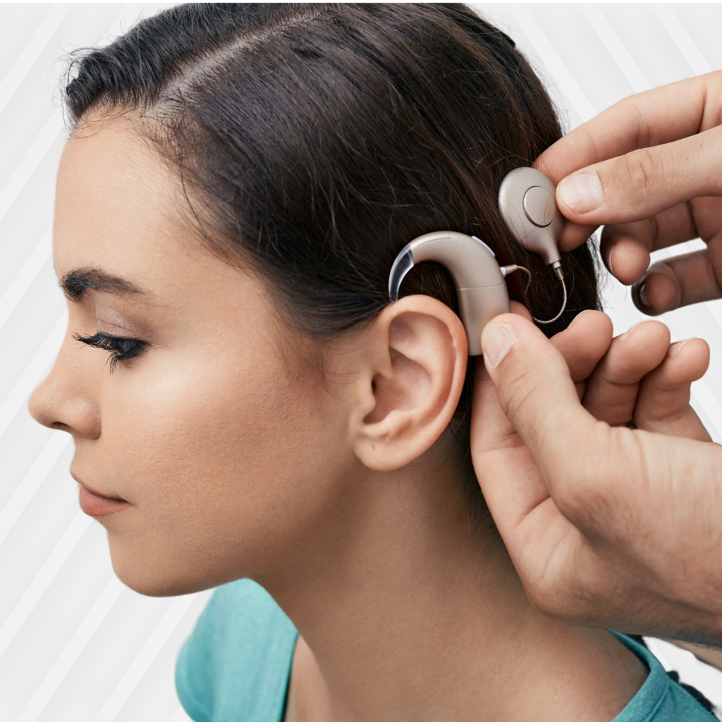 Cochlear Implantation Image